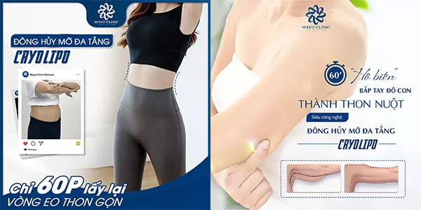 Ưu điểm nổi bật của công nghệ Cryo Lipo