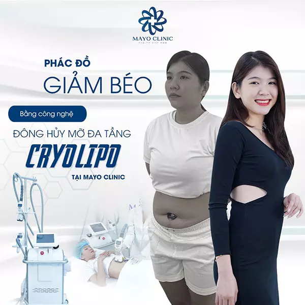 Phác đồ giảm béo bằng công nghệ đông hủy mỡ đa tầng Cryo Lipo