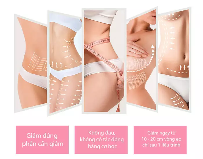 Giảm béo bằng công nghệ Ultra Lipo