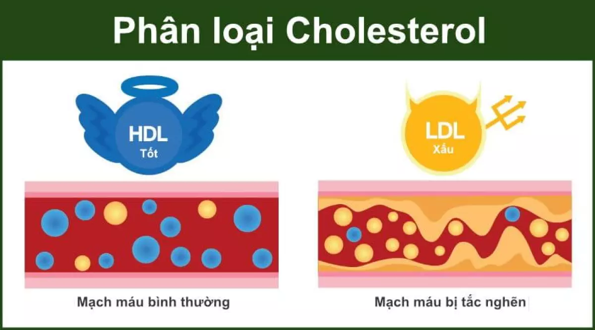 Máu mỡ cao