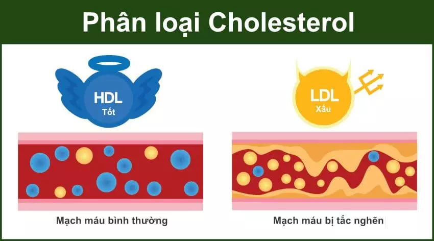 Tác động của mỡ máu cao