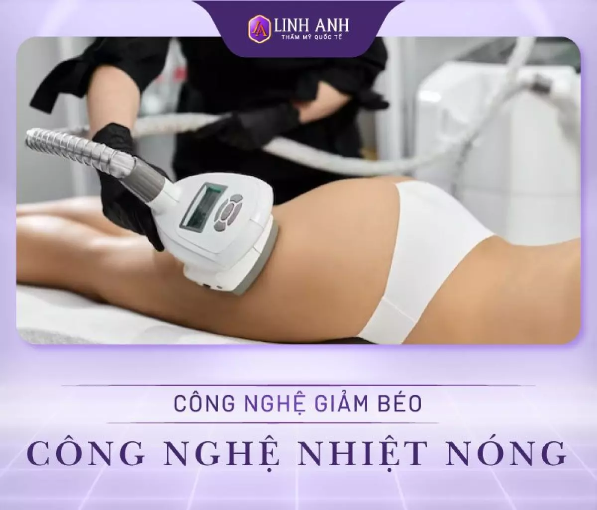 Công nghệ giảm béo - Công nghệ nhiệt nóng