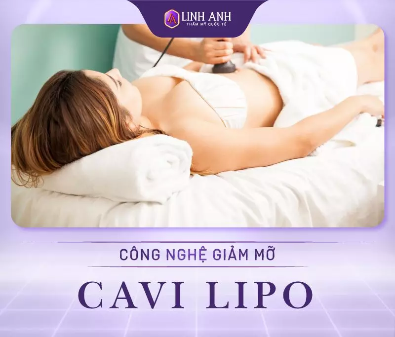 Công nghệ giảm mỡ Cavi Lipo