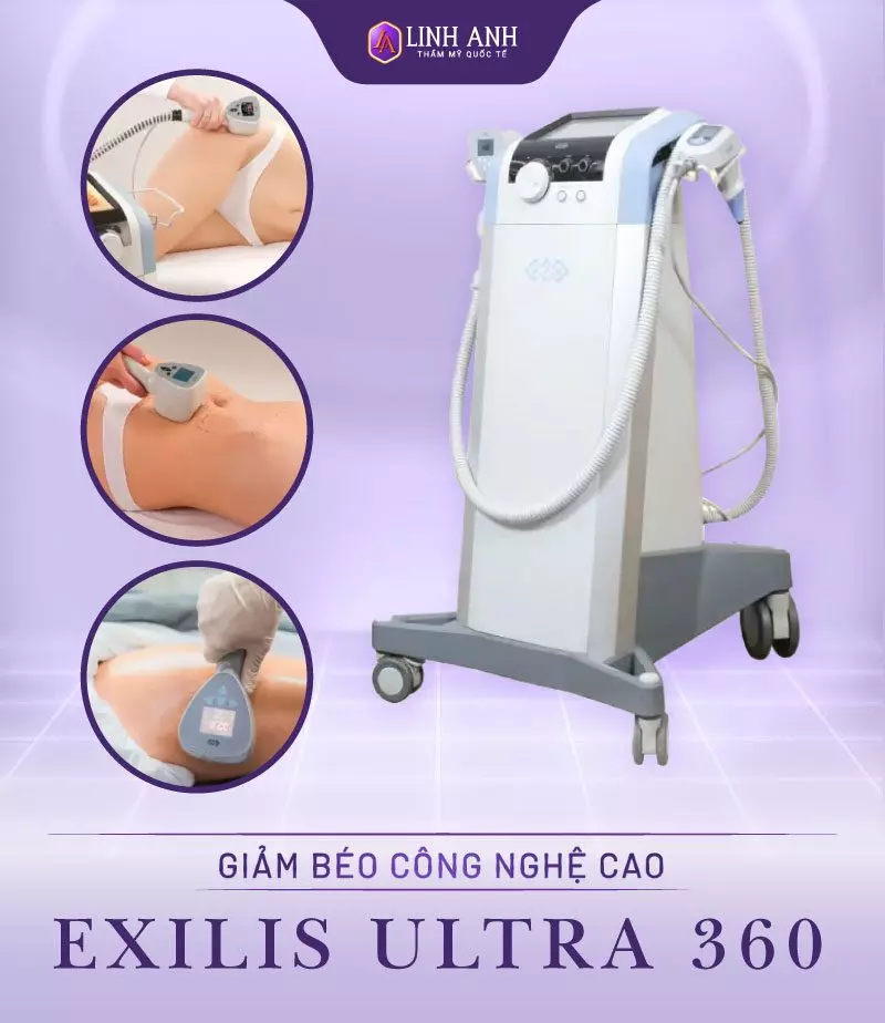 Giảm béo công nghệ cao Exilis Ultra 360