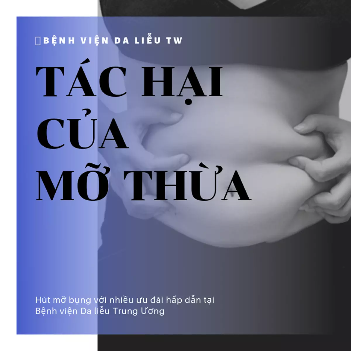 Mỡ thừa