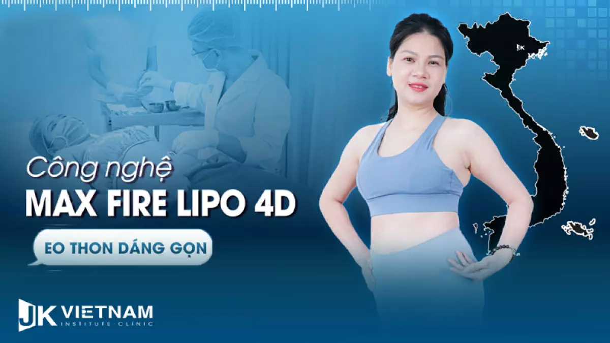 Công nghệ MaxFire Lipo 4D là công nghệ giảm béo tốt bậc nhất trên thị trường