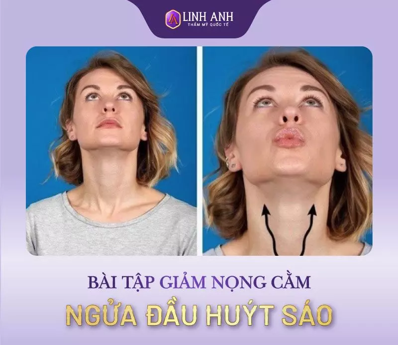 Bài tập giảm nọng cằm - Ngửa đầu huýt sáo