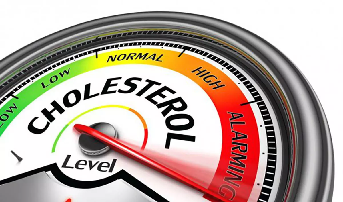 Cholesterol