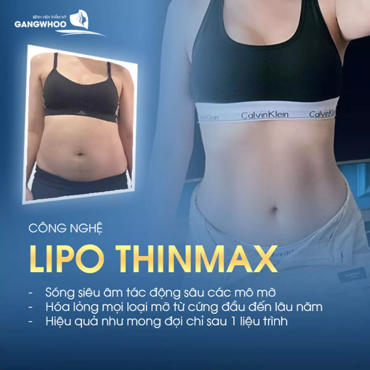 lipo thin max