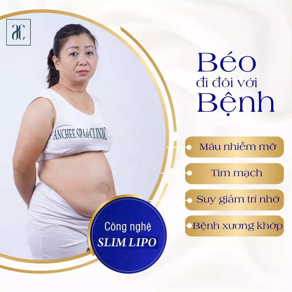 Tiêm giảm béo CONTRI LIPO có hiệu quả không? Giá bao nhiêu? Bảng giá [2022]