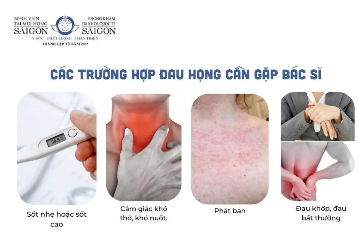 Các trường hợp đau họng nên gặp bác sĩ kịp thời để chữa trị