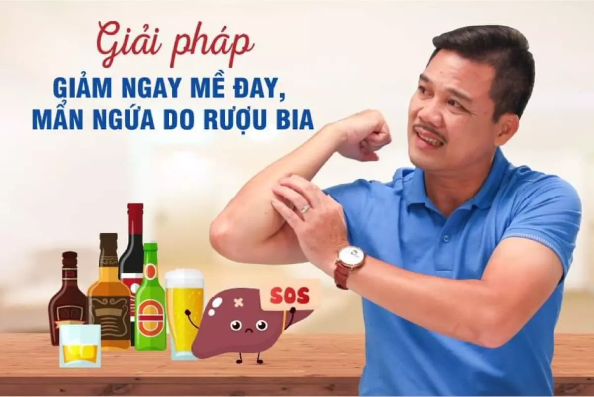 Giải pháp giảm mề đay, mẩn ngứa do rượu bia