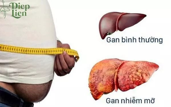 30 lợi ích tốt cho sức khỏe từ lá sen và hoa sen