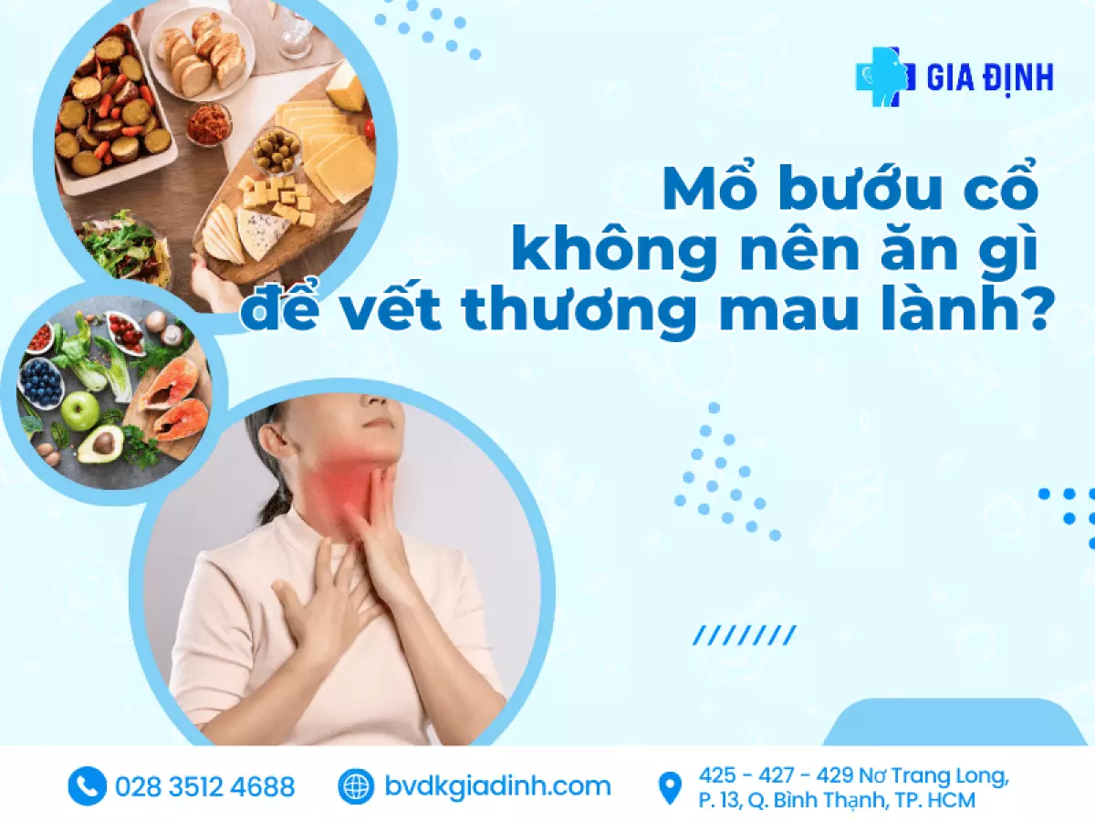 Mổ bướu cổ không nên ăn gì