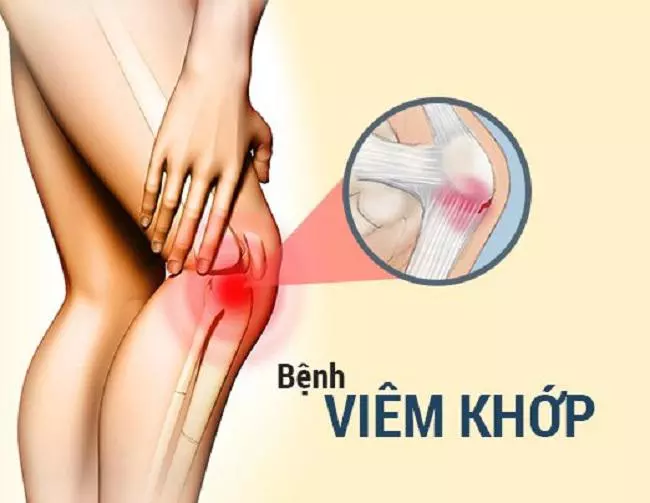 Cách bổ sung dinh dưỡng cho xương khớp