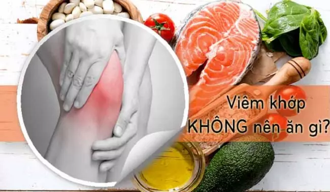 Cách bổ sung dinh dưỡng cho xương khớp