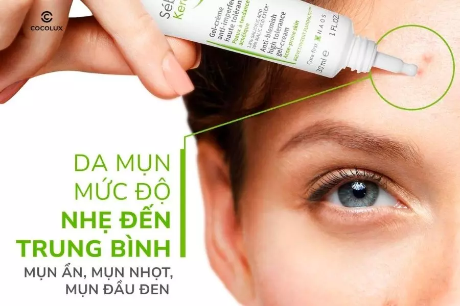 Kem dưỡng Bioderma Sebium Kerato hiệu quả với làn da mụn