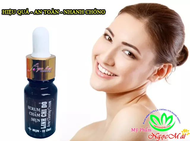 chỉ vàng dori beauty new today