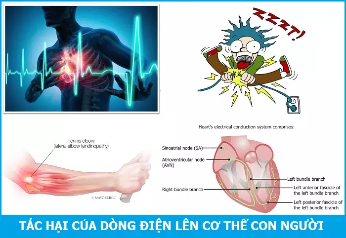 Tác hại của dòng điện lên cơ thể con người