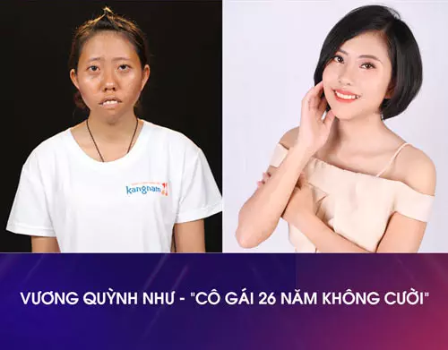 cách làm xương mặt nhỏ lại