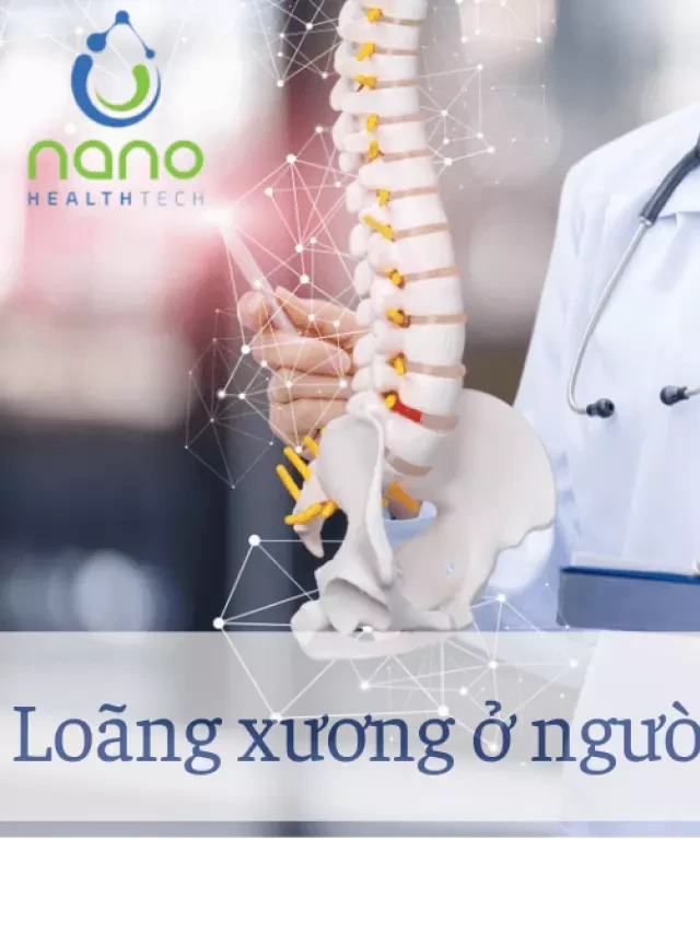   TOP 6 loại sữa xương khớp cho người trung niên tốt nhất