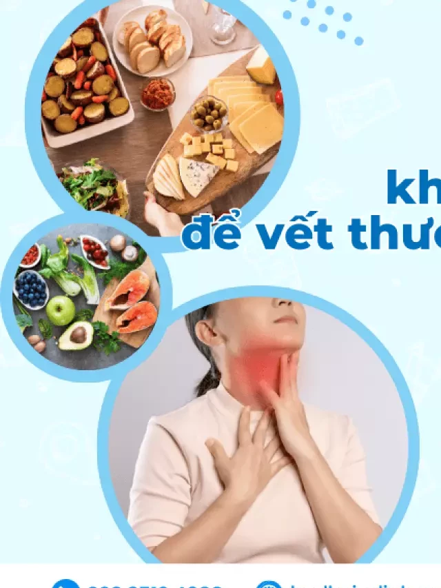   Mổ bướu cổ không nên ăn gì để vết thương mau hồi phục