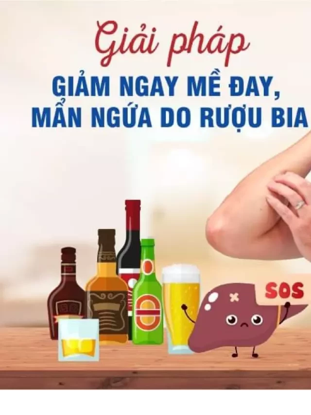   Giải Pháp Giảm Mề Đay, Mẩn Ngứa Do Rượu Bia