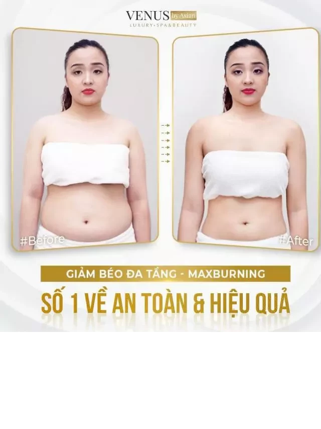   Công nghệ giảm cân cho người béo lâu năm giúp giảm từ 15 - 20cm 1 lần duy nhất