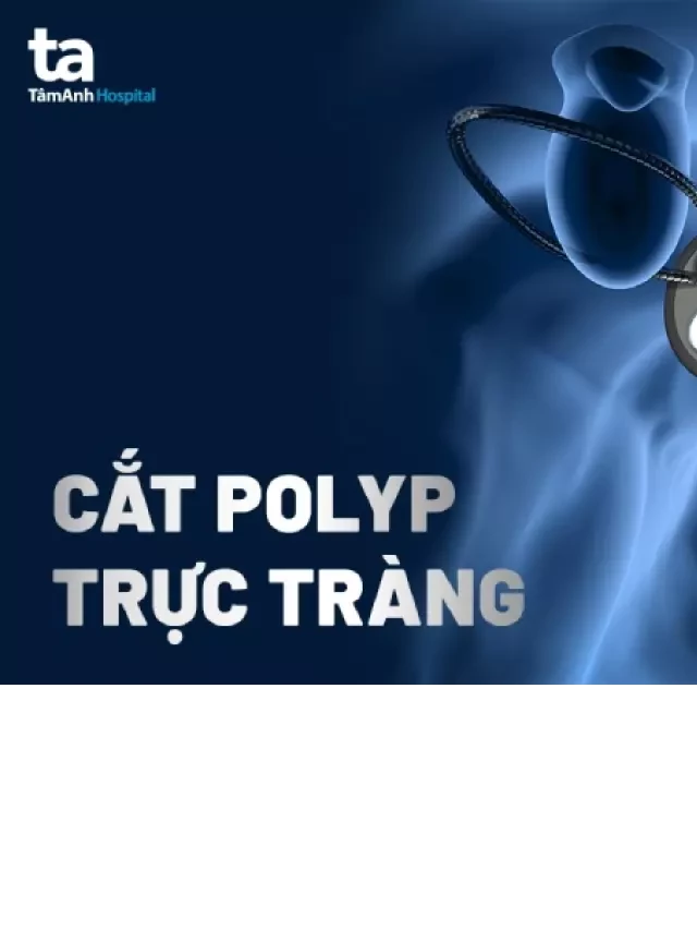   Cắt polyp trực tràng: Một phương pháp hiện đại để đảm bảo sức khỏe