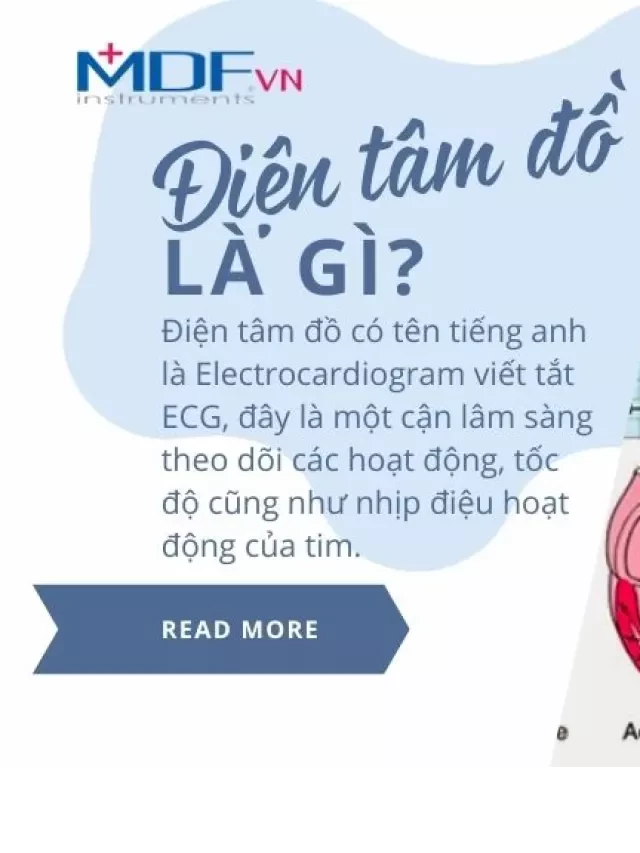   [Chi tiết A-Z] Cách mắc điện cực trong điện tâm đồ