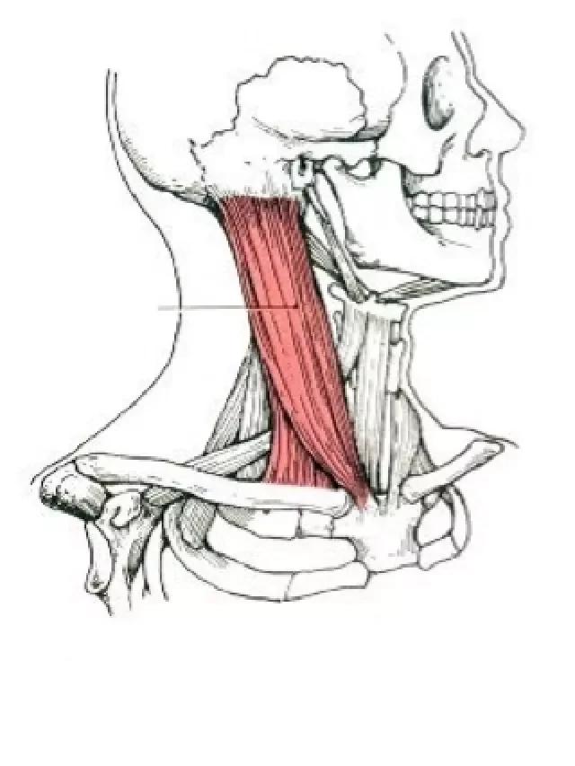   Tìm hiểu về bệnh xơ cơ ức đòn chũm - Hiểm họa đe dọa trẻ nhỏ