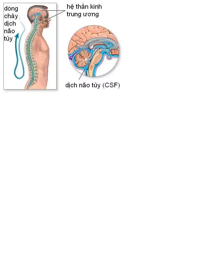   Trung tâm chẩn đoán hình ảnh Medlatec: Đánh giá và điều trị bệnh nang Tarlov