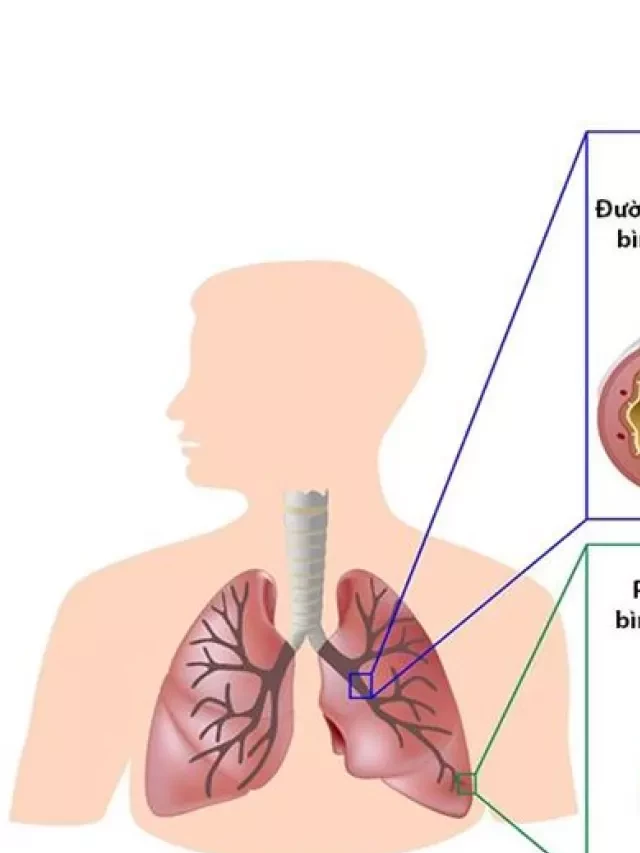   BỊ HO ĂN XÔI ĐƯỢC KHÔNG? Câu trả lời được hé lộ tại đây!