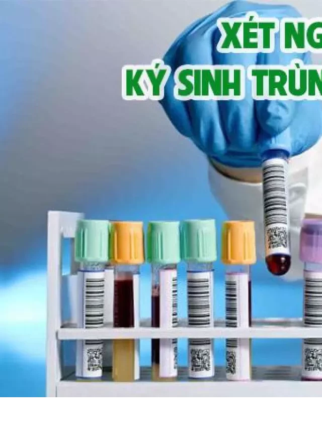   Xét nghiệm ký sinh trùng giun sán: Nhịn ăn có cần thiết không?