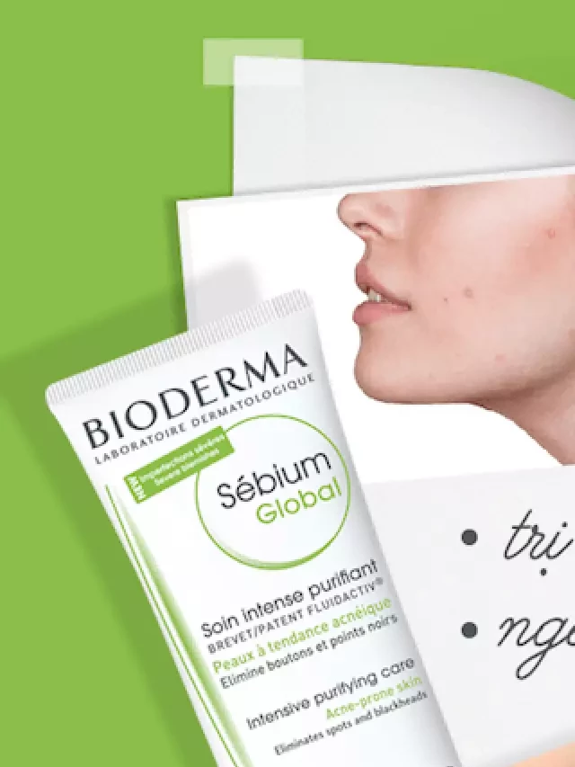   Review Kem Trị Mụn Viêm Bioderma - Sản phẩm được bác sĩ da liễu khuyên dùng