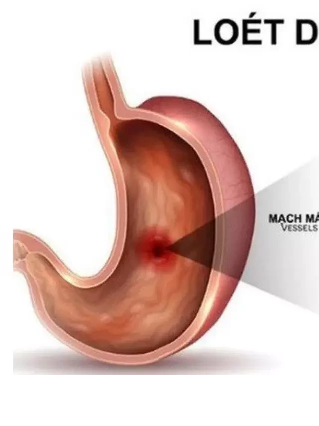   6 tác dụng đặc biệt của hoa đu đủ đực và cách sử dụng điều trị bệnh