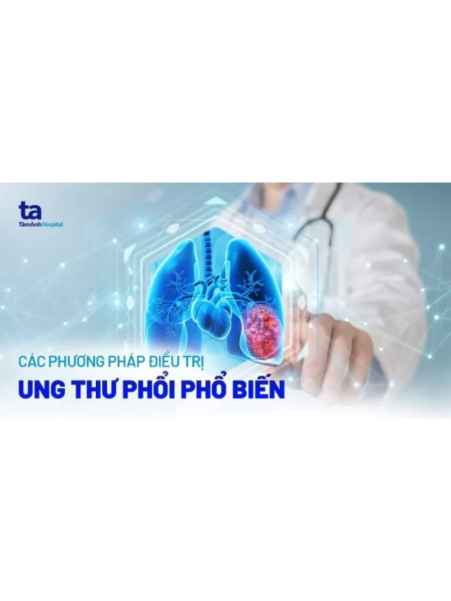   6+ phương pháp điều trị ung thư phổi phổ biến